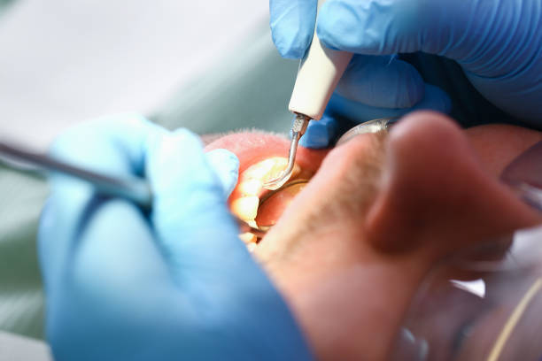 Best Emergency Root Canal Therapy in Topaz Ranch Estates, NV